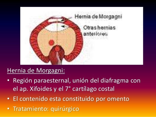 Hernias del hiato esofágico y diafragma