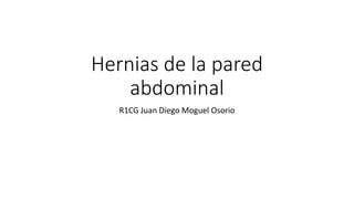 Hernias de la pared
abdominal
R1CG Juan Diego Moguel Osorio
 