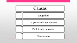 Causas
congenitas
La postura del ser humano
Deficiencia muscular
Tabaquismo
 