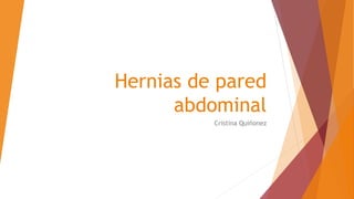 Hernias de pared
abdominal
Cristina Quiñonez
 