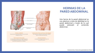 HERNIAS DE LA PARED ABDOMINAL | PPTX