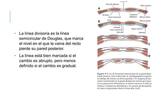 • La línea divisoria es la línea
semicircular de Douglas, que marca
el nivel en el que la vaina del recto
pierde su pared posterior.
• La línea está bien marcada si el
cambio es abrupto, pero menos
definido si el cambio es gradual.
 