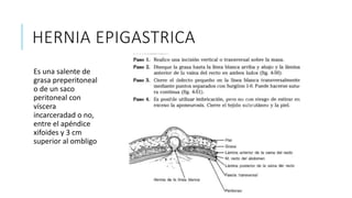 HERNIA EPIGASTRICA
Es una salente de
grasa preperitoneal
o de un saco
peritoneal con
víscera
incarceradad o no,
entre el apéndice
xifoides y 3 cm
superior al ombligo
 