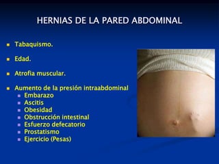 HERNIAS DE LA PARED ABDOMINAL
 Tabaquismo.
 Edad.
 Atrofia muscular.
 Aumento de la presión intraabdominal
 Embarazo
 Ascitis
 Obesidad
 Obstrucción intestinal
 Esfuerzo defecatorio
 Prostatismo
 Ejercicio (Pesas)
 