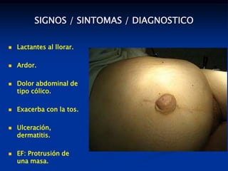 SIGNOS / SINTOMAS / DIAGNOSTICO
 Lactantes al llorar.
 Ardor.
 Dolor abdominal de
tipo cólico.
 Exacerba con la tos.
 Ulceración,
dermatitis.
 EF: Protrusión de
una masa.
 