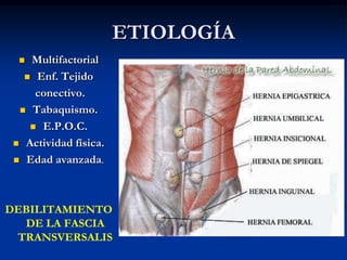 ETIOLOGÍA
 Multifactorial
 Enf. Tejido
conectivo.
 Tabaquismo.
 E.P.O.C.
 Actividad física.
 Edad avanzada.
DEBILITAMIENTO
DE LA FASCIA
TRANSVERSALIS
 