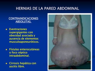 HERNIAS DE LA PARED ABDOMINAL
CONTRAINDICACIONES
ABSOLUTAS.
 Eventraciones
supergigantes con
obesidad asociada y
ausencia de elementos
musculoaponeuróticos.
 Fístulas enterocutáneas
o foco séptico
intraabdominal.
 Cirrosis hepática con
ascitis libre.
 