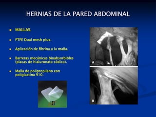 HERNIAS DE LA PARED ABDOMINAL
 MALLAS.
 PTFE Dual mesh plus.
 Aplicación de fibrina a la malla.
 Barreras mecánicas bioabsorbibles
(placas de hialuronato sódico).
 Malla de polipropileno con
poliglactina 910.
 