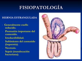FISIOPATOLOGÍA
HERNIA ESTRANGULADA
- Generalmente cuello
reducido.
- Protrusión importante del
contenido.
- Irreductibilidad.
- Sufrimiento del contenido
(isquemia).
- Necrosis.
- Sepsis (translocación
bacteriana).
 