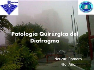 Patología Quirúrgica del
Diafragma
Neucari Romero.
4to. Año.
 