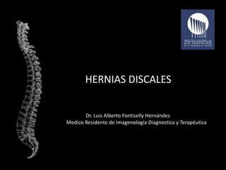 HERNIAS DISCALES 
Dr. Luis Alberto Fontiselly Hernández 
Medico Residente de Imagenologia Diagnostica y Terapéutica 
 