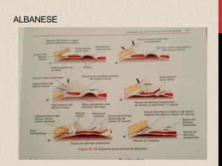 ALBANESE
 