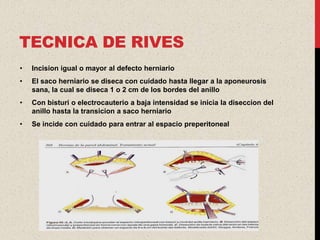 TECNICA DE RIVES
•   Incision igual o mayor al defecto herniario
•   El saco herniario se diseca con cuidado hasta llegar a la aponeurosis
    sana, la cual se diseca 1 o 2 cm de los bordes del anillo
•   Con bisturi o electrocauterio a baja intensidad se inicia la diseccion del
    anillo hasta la transicion a saco herniario
•   Se incide con cuidado para entrar al espacio preperitoneal
 