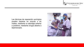 Las técnicas de reparación quirúrgica
pueden basarse en suturas o en
mallas, mediante un abordaje anterior
o posterior, mediante cirugía abierta o
laparoscopia.
 