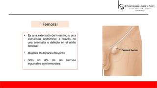 • Es una extensión del intestino u otra
estructura abdominal a través de
una anomalía o defecto en el anillo
femoral.
• Mujeres multíparas mayores
• Solo un 4% de las hernias
inguinales son femorales
Femoral
 