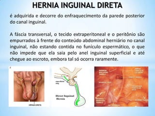 HERNIA INGUINAL DIRETA
é adquirida e decorre do enfraquecimento da parede posterior
do canal inguinal.

A fáscia transversal, o tecido extraperitoneal e o peritônio são
empurrados à frente do conteúdo abdominal herniário no canal
inguinal, não estando contida no funículo espermático, o que
não impede que ela saia pelo anel inguinal superficial e até
chegue ao escroto, embora tal só ocorra raramente.
 