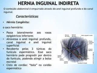 HERNIA INGUINAL INDIRETA
O conteúdo abdominal é empurrado através do anel inguinal profundo e do canal
inguinal.
          Características
• Hérnia Congênita:
o saco herniário:
• Passa    lateralmente   aos    vasos
  epigástricos inferiores
• Atravessa o anel inguinal profundo,
  canal inguinal e anel inguinal
  superficial
• Recoberto pelas 3 túnicas do
  funículo espermático. Esse saco
  herniário pode progredir por dentro
  do funículo, podendo atingir a bolsa
  escrotal
• Cisto de cordão: “bola” no cordão
  espermático
 