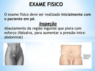 EXAME FISICO
O exame físico deve ser realizado inicialmente com
o paciente em pé.
                    Inspeção
Abaulamento da região inguinal que piora com
esforço (Valsalva, para aumentar a pressão intra-
abdominal)
 