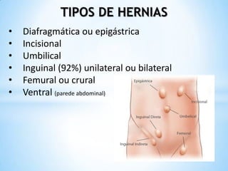 TIPOS DE HERNIAS
•   Diafragmática ou epigástrica
•   Incisional
•   Umbilical
•   Inguinal (92%) unilateral ou bilateral
•   Femural ou crural
•   Ventral (parede abdominal)
 