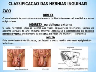 CLASSIFICACAO DAS HERNIAS INGUINAIS
TIPO
                                    DIRETA
O saco herniário provoca um abaulamento da fáscia transversal, medial aos vasos
epigástricos
                        INDIRETA ou obliqua externa
O saco herniário situa-se lateral aos vasos epigástricos inferiores, saindo do
abdome através do anel inguinal interno. Associa-se a persistência do conduto
peritônio vaginal (no homem) ou do canal de Nuck (na mulher) → congênita
                                       MISTA
Dois sacos herniários distintos, um lateral e outro medial aos vasos epigástricos
inferiores.
 