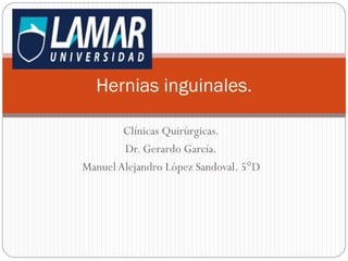 Hernias inguinales.
Clínicas Quirúrgicas.
Dr. Gerardo García.
Manuel Alejandro López Sandoval. 5°D

 