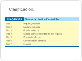 Clasificación.

 
