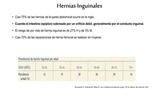 Hernias Inguinales
• Casi 75% de las hernias de la pared abdominal ocurre en la ingle.
• Cuando el intestino (epiplon) sobresale por un orificio debil, generalmente por el conducto inguinal.
• El riesgo de por vida de hernia inguinal es de 27% H y de 3% M.
• Casi 70% de las reparaciones de hernia femoral se realizan en mujeres.
Brunicardi CF, Anderse KD, Billiar RT, et al. Schwartz principios de cirugía. 10ª Ed. México: Mc Graw-Hill; 2015
 