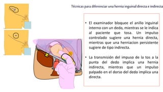 Técnicas para diferenciar una hernia inguinaldirecta e indirecta
• El examinador bloquee el anillo inguinal
interno con un dedo, mientras se le indica
al paciente que tosa. Un impulso
controlado sugiere una hernia directa,
mientras que una herniacion persistente
sugiere de tipo indirecta.
• La transmisión del impuso de la tos a la
punta del dedo implica una hernia
indirecta, mientras que un impulso
palpado en el dorso del dedo implica una
directa.
 