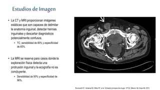 • La CT y MRI proporcionan imágenes
estáticas que son capaces de delimitar
la anatomía inguinal, detectar hernias
inguinales y descartar diagnósticos
potencialmente confusos.
• TC: sensibilidad de 80% y especificidad
de 65%.
• La MRI se reserva para casos donde la
exploración física detecta una
protrusión inguinal y la ecografía no es
concluyente.
• Sensibilidad de 95% y especificidad de
96%.
Brunicardi CF, Anderse KD, Billiar RT, et al. Schwartz principios de cirugía. 10ª Ed. México: Mc Graw-Hill; 2015
 