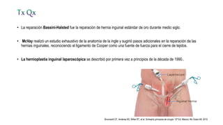 • La reparación Bassini-Halsted fue la reparación de hernia inguinal estándar de oro durante medio siglo.
• McVay realizó un estudio exhaustivo de la anatomía de la ingle y sugirió pasos adicionales en la reparación de las
hernias inguinales, reconociendo el ligamento de Cooper como una fuente de fuerza para el cierre de tejidos.
• La hernioplastia inguinal laparoscópica se describió por primera vez a principios de la década de 1990..
Brunicardi CF, Anderse KD, Billiar RT, et al. Schwartz principios de cirugía. 10ª Ed. México: Mc Graw-Hill; 2015
 