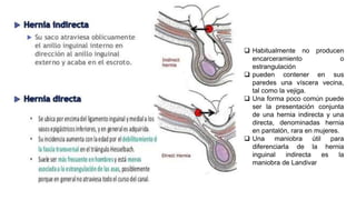  Habitualmente no producen
encarceramiento o
estrangulación
 pueden contener en sus
paredes una víscera vecina,
tal como la vejiga.
 Una forma poco común puede
ser la presentación conjunta
de una hernia indirecta y una
directa, denominadas hernia
en pantalón, rara en mujeres.
 Una maniobra útil para
diferenciarla de la hernia
inguinal indirecta es la
maniobra de Landivar
 