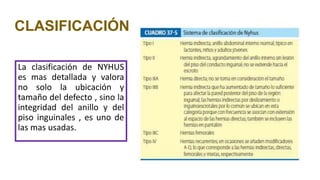 CLASIFICACIÓN
La clasificación de NYHUS
es mas detallada y valora
no solo la ubicación y
tamaño del defecto , sino la
integridad del anillo y del
piso inguinales , es uno de
las mas usadas.
 