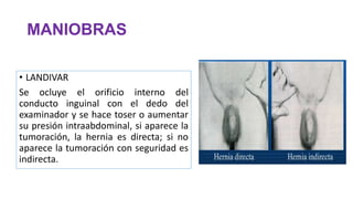MANIOBRAS
• LANDIVAR
Se ocluye el orificio interno del
conducto inguinal con el dedo del
examinador y se hace toser o aumentar
su presión intraabdominal, si aparece la
tumoración, la hernia es directa; si no
aparece la tumoración con seguridad es
indirecta.
 