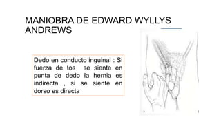 MANIOBRA DE EDWARD WYLLYS
ANDREWS
Dedo en conducto inguinal : Si
fuerza de tos se siente en
punta de dedo la hernia es
indirecta , si se siente en
dorso es directa
 