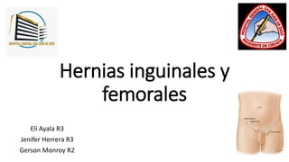 Hernias inguinales y
femorales
Elí Ayala R3
Jenifer Herrera R3
Gerson Monroy R2
 