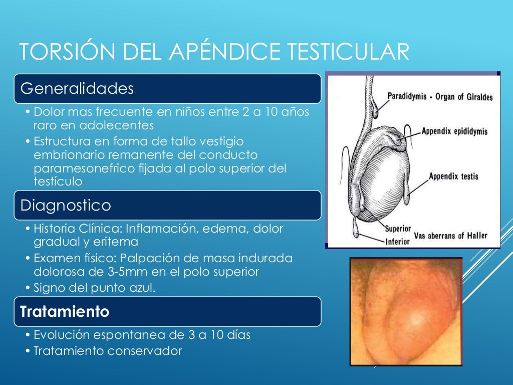 Hernias inguinales y torsion testicular