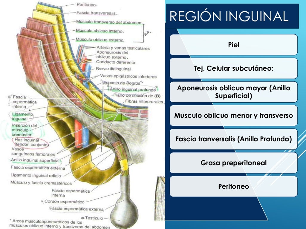 Hernias inguinales y torsion testicular