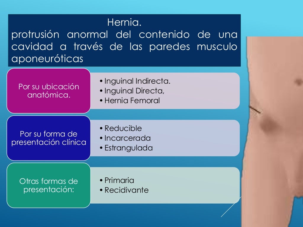 Hernias inguinales y torsion testicular