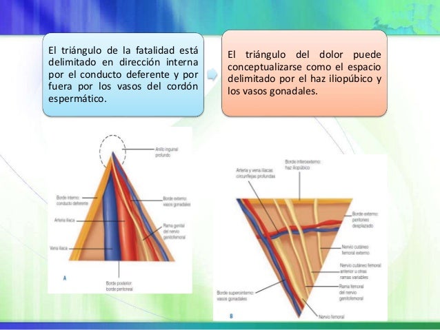 HERNIAS INGUINOCRURALES