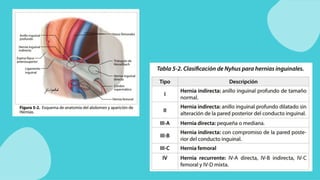 Comprehensive Overview of Abdominal Wall Hernias: Types, Diagnosis, and ...