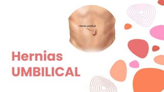 Hernias
UMBILICAL
 