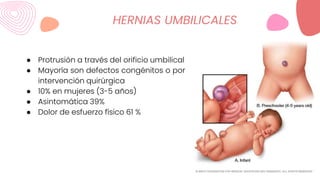● Protrusión a través del orificio umbilical
● Mayoría son defectos congénitos o por
intervención quirúrgica
● 10% en mujeres (3-5 años)
● Asintomática 39%
● Dolor de esfuerzo físico 61 %
HERNIAS UMBILICALES
 