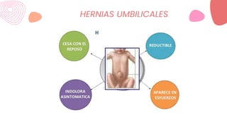 HERNIAS UMBILICALES
 