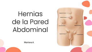 Hernias
de la Pared
Abdominal
Mariana A
 