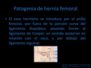 Patogenia de hernia femoral
• El saco herniario se introduce por el anillo
femoral, por fuera de la porción curva del
ligamento iliopúbico, pasando frente al
ligamento de Cooper, en sentido posterior en
relación con el saco, y por debajo del
ligamento inguinal.
Hernias de la pared abdominal. Tratamiento actual.
2da edición 2009. Mayagoitia. Sección V Hernias poco
comunes
 