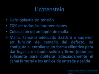 Lichtenstein
• Hernioplastía sin tensión
• 70% de todas las intervenciones
• Colocación de un tapón de malla
• Malla: Tamaño adecuado 2x20cm o superior
en función del tamaño del defecto, se
configura al enrollarse en forma cilíndrica para
dar lugar a un tapón sólido y firme (debe ser
suficiente para obliterar adecuadamente el
canal femoral y los anillos de entrada y salida
Hernias de la pared abdominal. Tratamiento actual.
2da edición 2009. Mayagoitia. Sección V Hernias poco
comunes
 