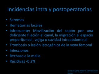 Incidencias intra y postoperatorias
• Seromas
• Hematomas locales
• Infrecuente: Movilización del tapón por una
deficiente fijación al canal, la migración al espacio
preperitoneal, vejiga o cavidad intraabdominal
• Trombosis o lesión iatrogénica de la vena femoral
• Infecciones
• Rechazo a la malla
• Recidivas -0.2%
Hernias de la pared abdominal. Tratamiento actual.
2da edición 2009. Mayagoitia. Sección V Hernias poco
comunes
 