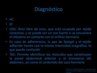 Diagnóstico
• HC
• EF
• USG: Área libre de ecos, que está ocupada por tejido
conectivo, y se puede ver un eco fuerte si se encuentra
el intestino en contacto con el orificio herniario
• En caso de adherencias, la apo de Spiegel y el tejido
adherido tienen casi la misma intensidad ecográfica, lo
que puede confundir
• TAC: Permite identificar los músculos que constituyen
la pared abdominal anterior y el transverso del
abdomen, así como el contenido del saco herniario
Hernias de la pared abdominal. Tratamiento actual.
2da edición 2009. Mayagoitia. Sección V Hernias poco
comunes
 