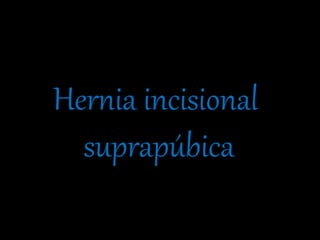 Hernia incisional
suprapúbica
 