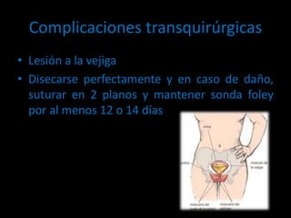Complicaciones transquirúrgicas
• Lesión a la vejiga
• Disecarse perfectamente y en caso de daño,
suturar en 2 planos y mantener sonda foley
por al menos 12 o 14 días
 